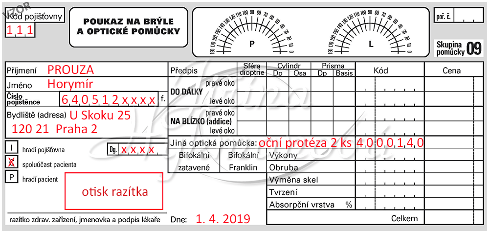 oční protéza