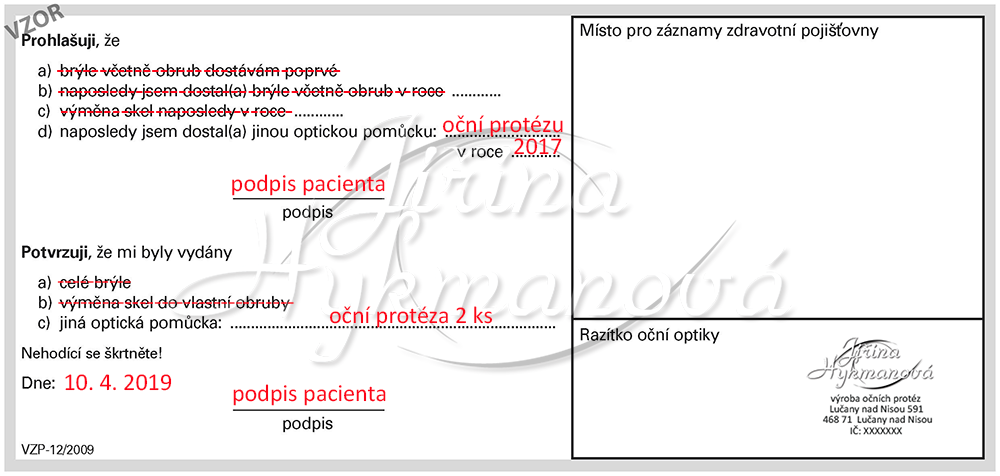 oční protéza